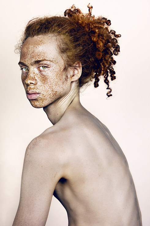 Why Do We Have Freckles On Our Face? - Frolicious ...